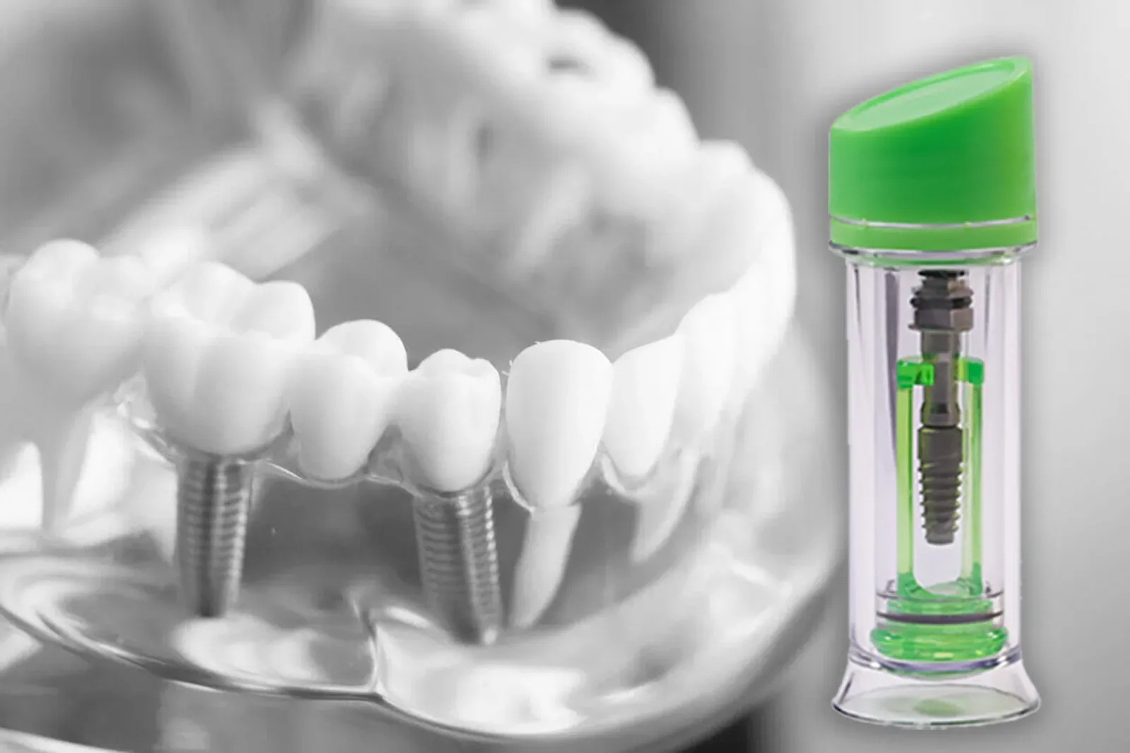 Cortex Dental Implants